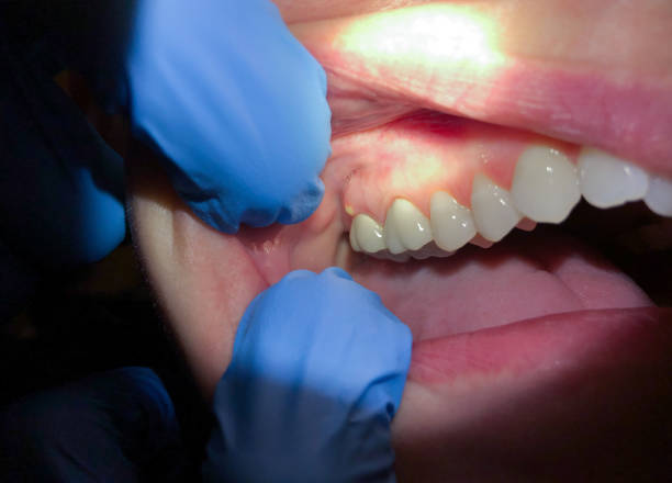 Best Emergency Dentist for Special Needs Patients in Cherryvale, KS